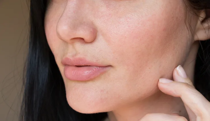 Close-up of a woman's face with fair skin and visible pores.