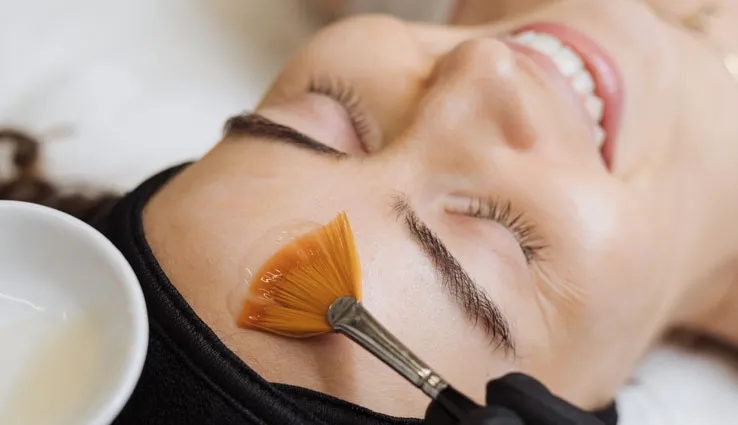 A PCA SKIN peel being applied to someone's face with a brush.