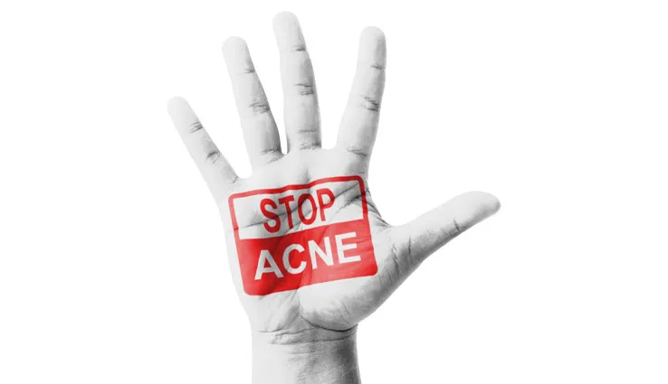 A black and white hand with "Stop Acne" written on it.