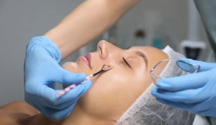 A woman gets a chemical peel.