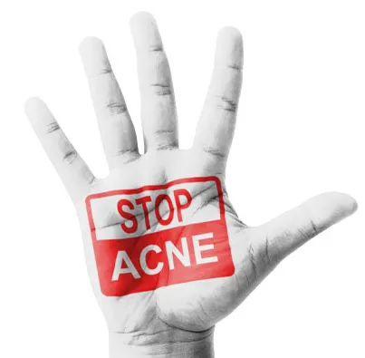 Prevent and reduce discoloration