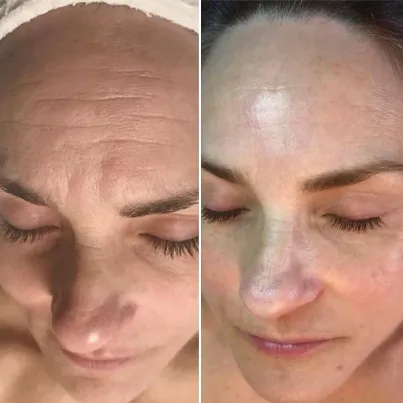 Look at these amazing results